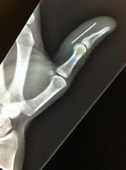 Life in the ER: Part 2