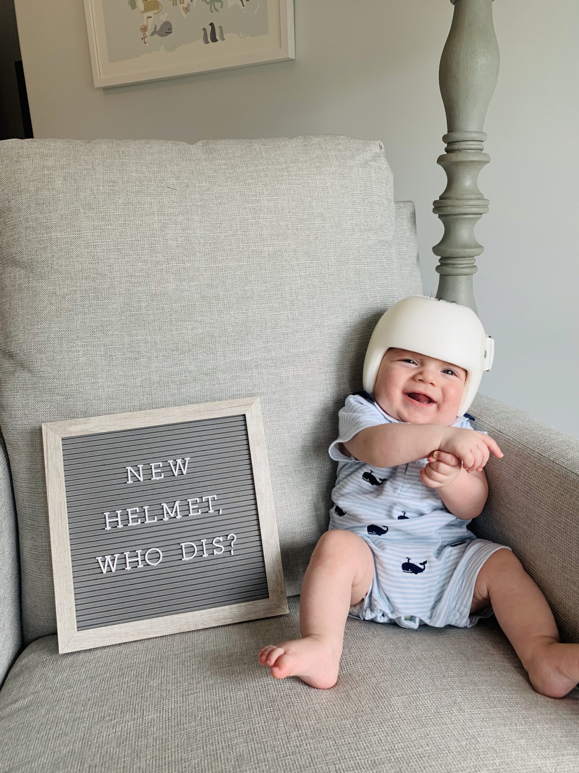 Helmet therapy best sale for infants