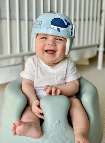 Porter’s Cranial Helmet Journey
